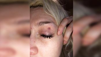 Militta Bora fue una víctima más de la violencia de género