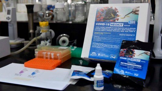 El detrás de cámaras del nuevo test rápido para coronavirus que interesa al mundo