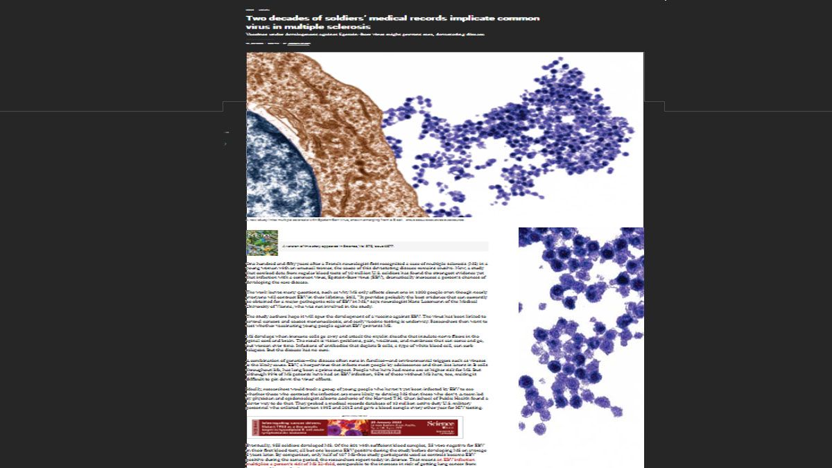 Avance en la Salud: Articulo de la revista Science sobre la relación de la mononucleosis con la Esclerosis Múltiple (Foto: Revista Science)