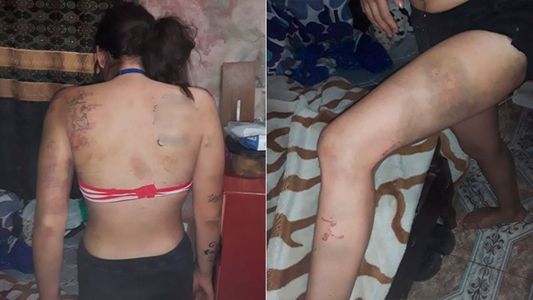 Horror: la secuestraron, abusaron y golpearon durante seis días