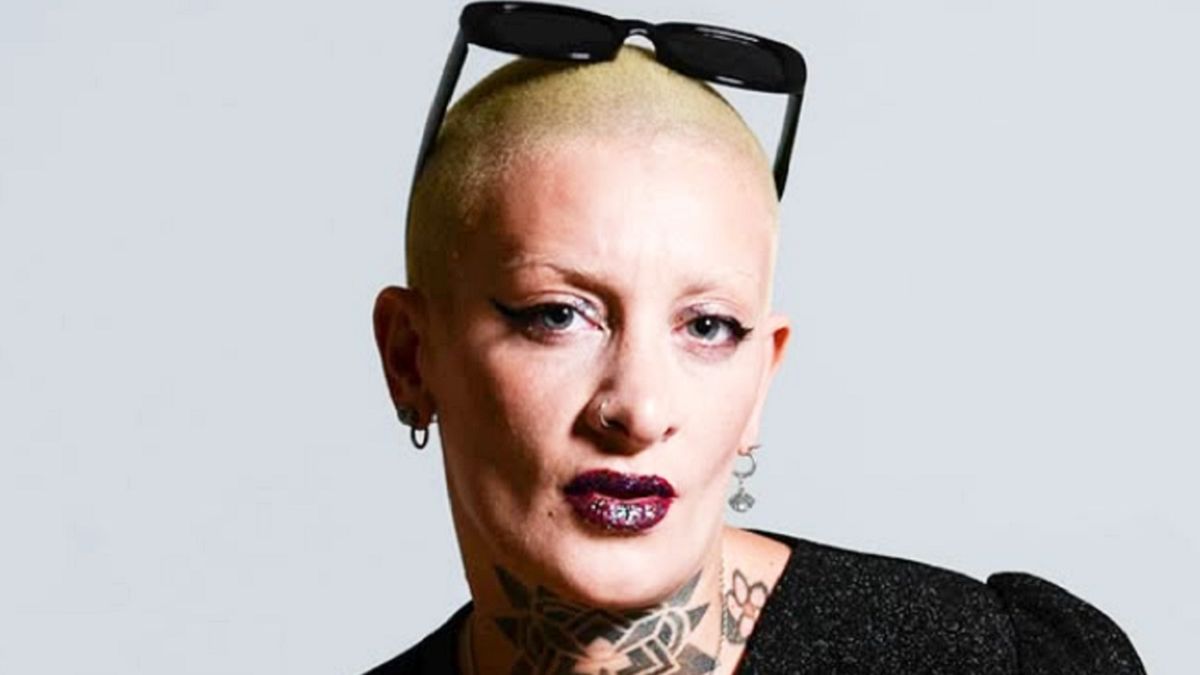 La complicación que tiene Furia para respirar tras operarse de la nariz: el impactante video