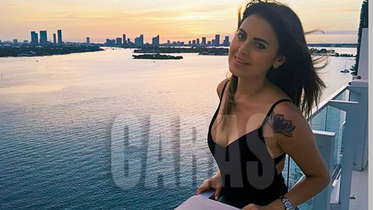 Silvina Luna se sacó el metacrilato de su cuerpo