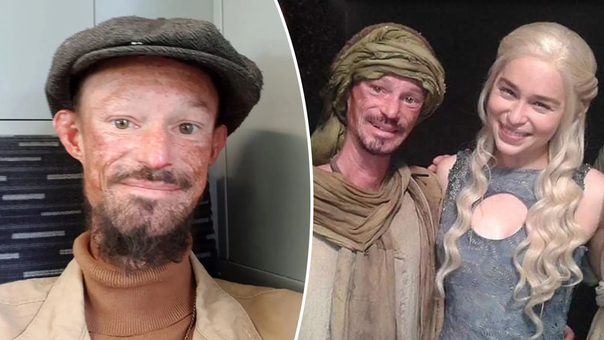 Muri&oacute; a los 36 a&ntilde;os por una dura enfermedad un actor de Game of Thrones