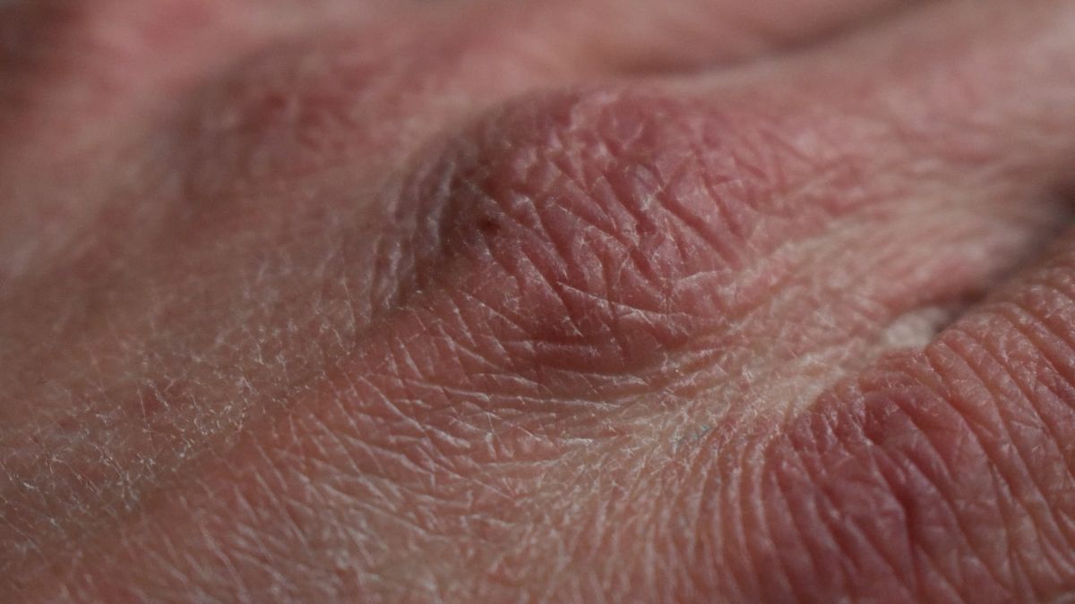 Las manos son unas de las partes del cuerpo más castigadas por el frío.