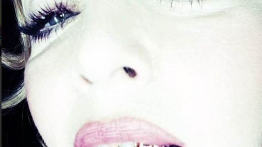 La sonrisa de Madonna es de oro y diamantes