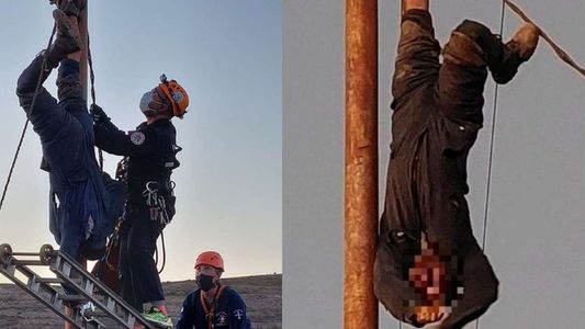 Robaba cables, se electrocutó, quedó colgado por horas y le amputarán un brazo