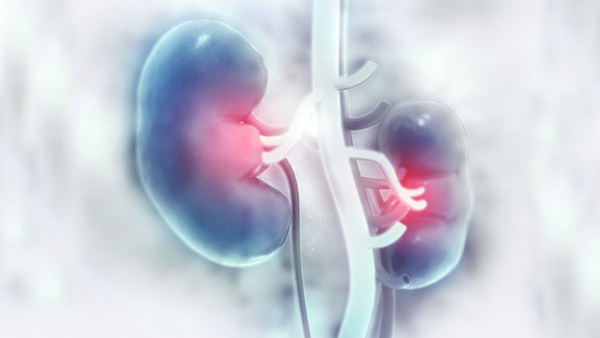 Insuficiencia renal aguda