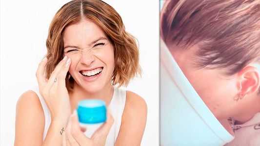 El particular tratamiento casero de la China Suárez para la piel de su cara