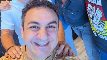 Diego Topa se hizo un retoque estético en la cara y la foto causó impacto: “10 años menos”