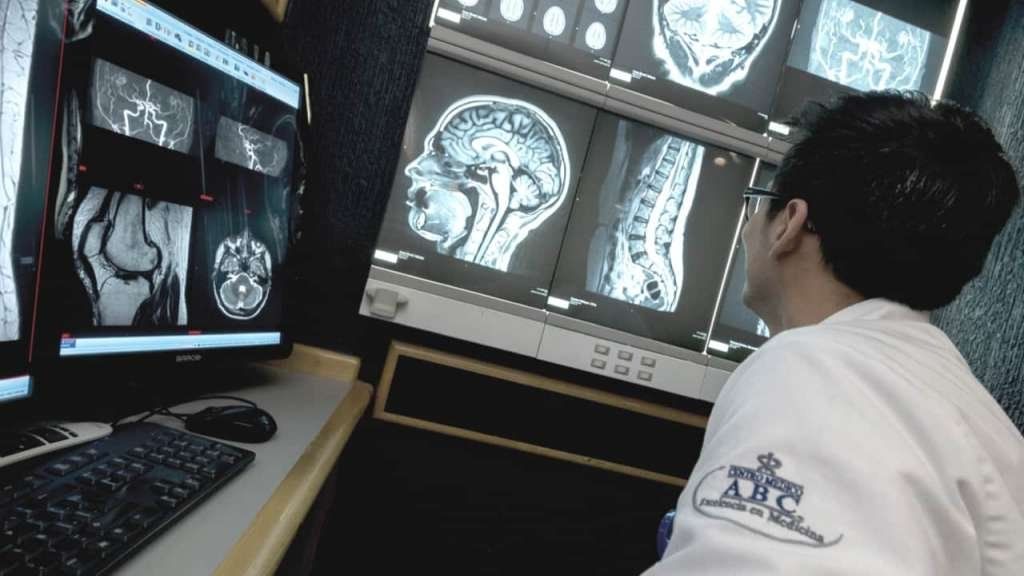 Coronavirus: sospechan que también ataca al sistema nervioso central