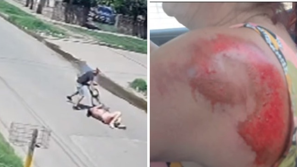 La mujer mostró sus heridas luego del intento de asalto que sufrió en la localidad de José C. Paz (Foto: captura de TV A24).