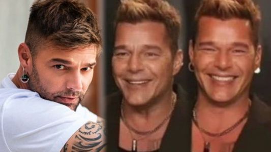Qué hay detrás de la nueva cara de Ricky Martin