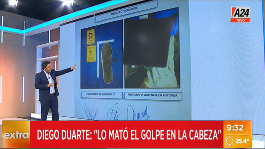 Declara el forense de Fernando Báez Sosa: las claves que encontró en el cuerpo tras la golpiza de los rugbiers