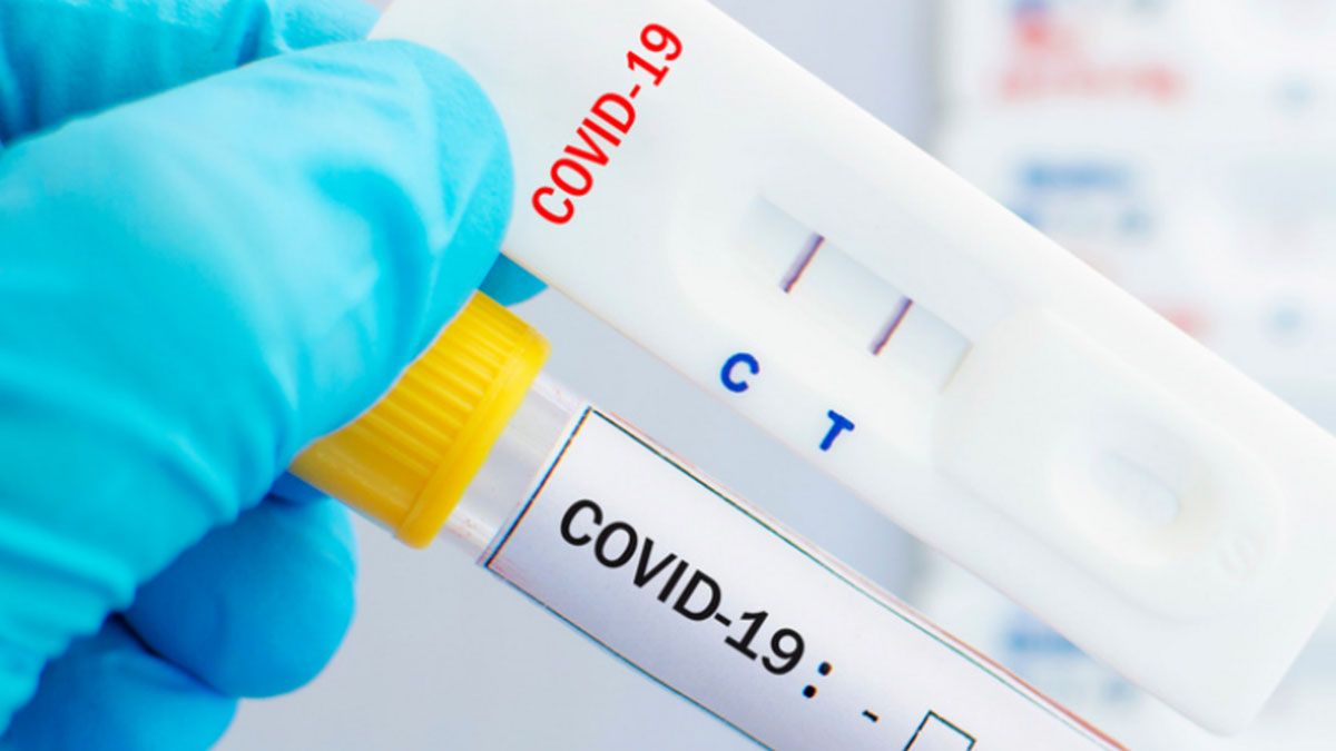El test de COVID-19.