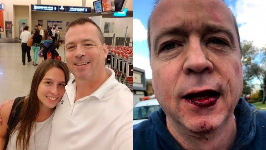 Habló el vecino del Barrio San Marco agredido: Yao Cabrera me podía haber matado