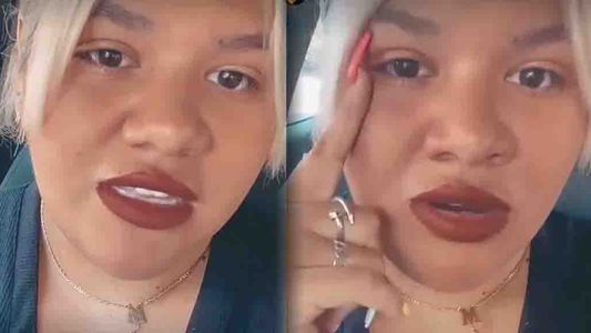 More Rial reveló cuántas cirugías se hizo: Me falta una cirugía para un poquito más adelante