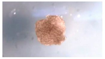 En Estados Unidos crearon los biobots, un híbrido entre ser vivo y robot y que abre la puerta a múltiples interrogantes