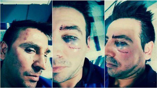 Quién es el preceptor que recibió una golpiza por parte del padre de una menor que lo denunció por acoso