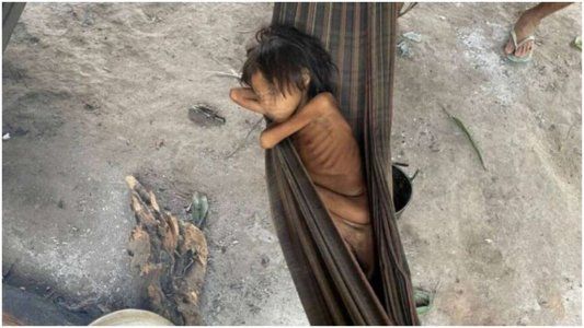 La foto que nadie quiere ver: una nena de 8 años que pesa sólo 12 kilos