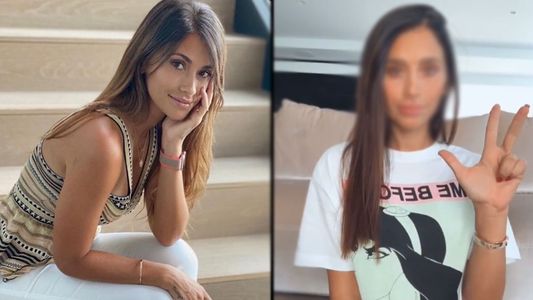Antonela Roccuzzo publicó un video en las redes y generó un escándalo: ¿Se operó la cara?